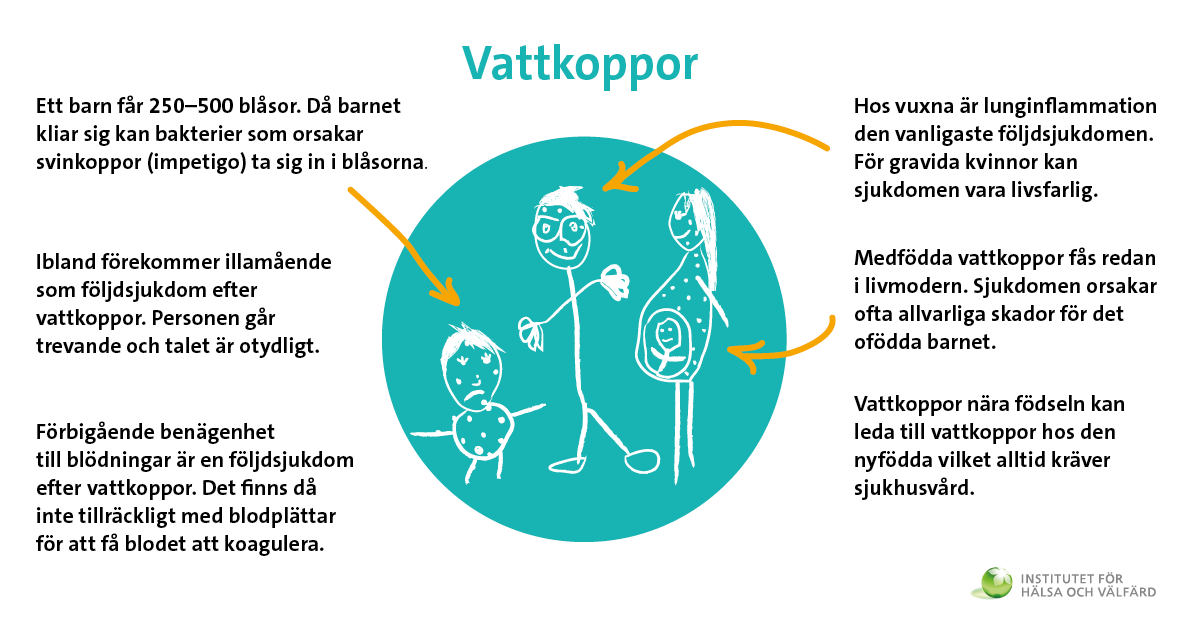 Infograf av vattkoppsinfektion.