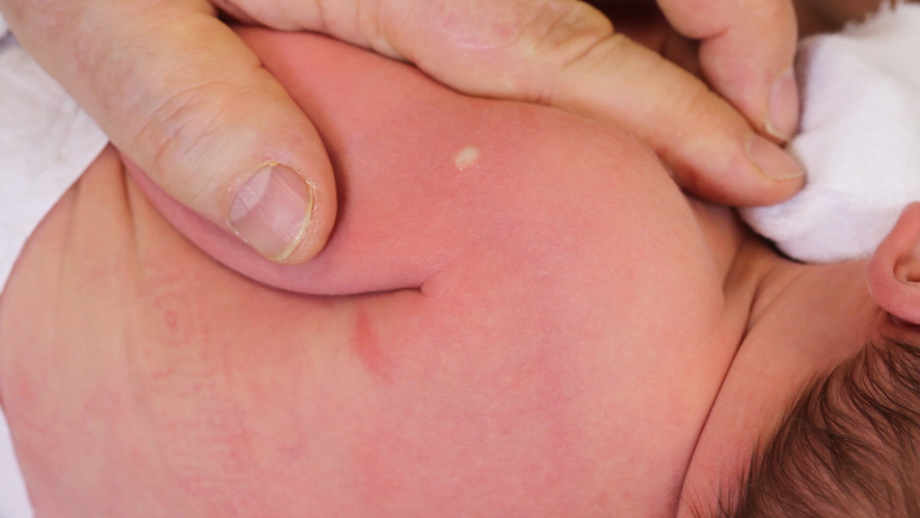 Rokotustekniikkakuva