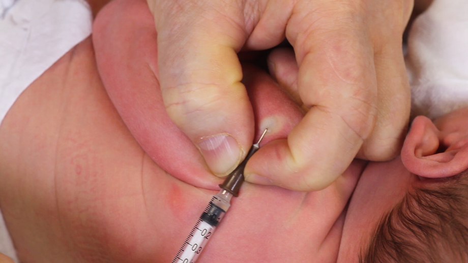 Rokotustekniikkakuva