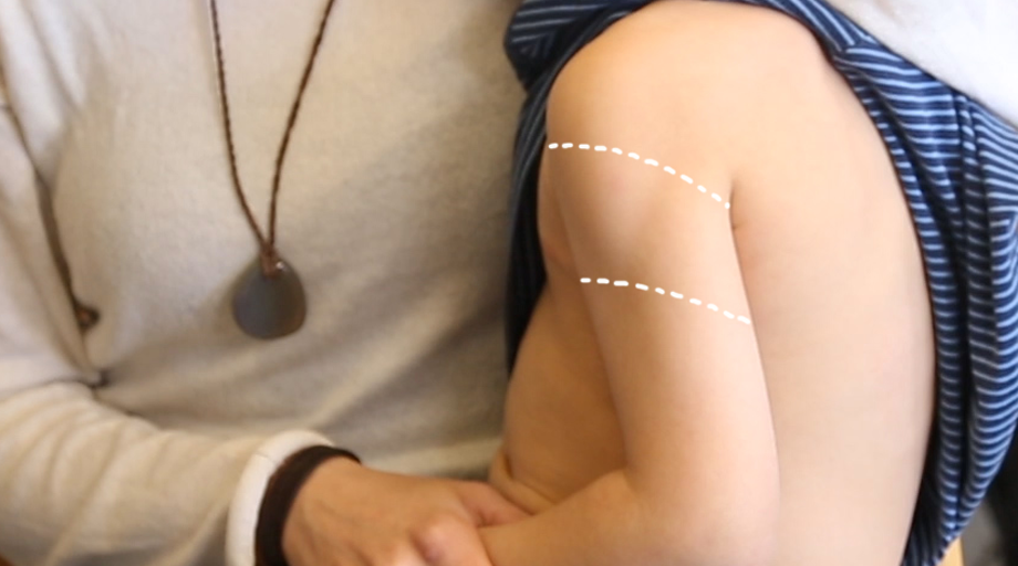 Rokotustekniikkakuva