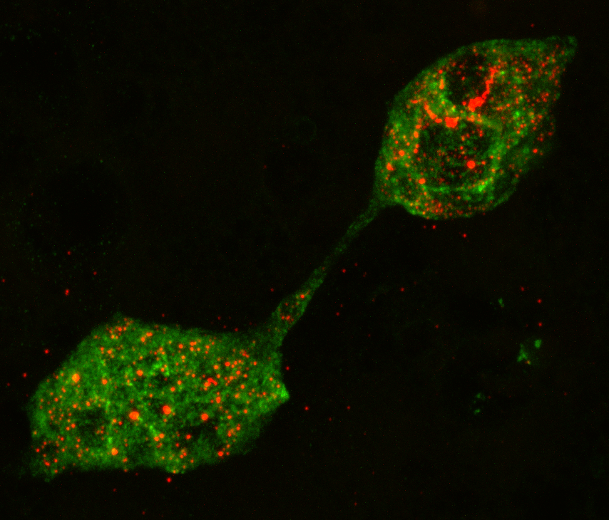 Confocal fluorescence microscopy picture of Calu3 cells infected with SARS-CoV-2. Viral N protein is  visualized in green and dsRNA in red. 